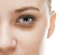 Phân biệt quần thâm và bọng mắt